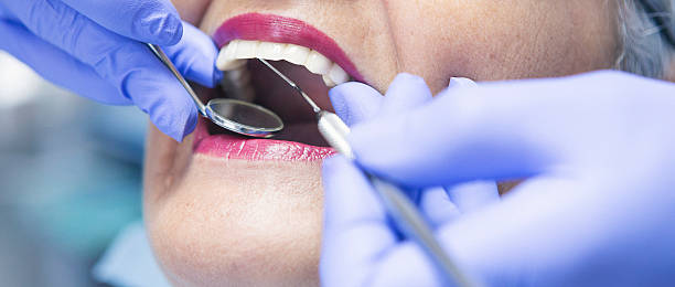 Best Chipped Tooth Repair Near Me  in Millersville, TN